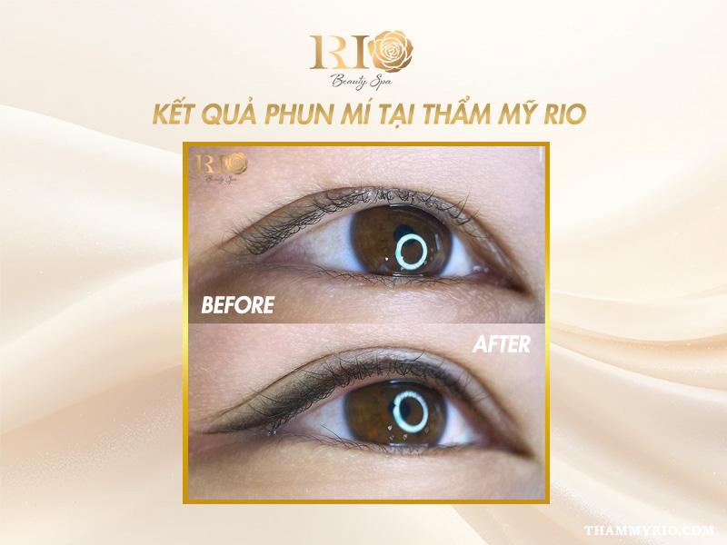 Giá phun mí mắt mới nhất - Ưu đãi phun mí mở tròng hot! 6 Đôi mắt to tròn, sắc nét sau khi thực hiện dịch vụ với giá phun mí mắt tại Thẩm Mỹ Rio.