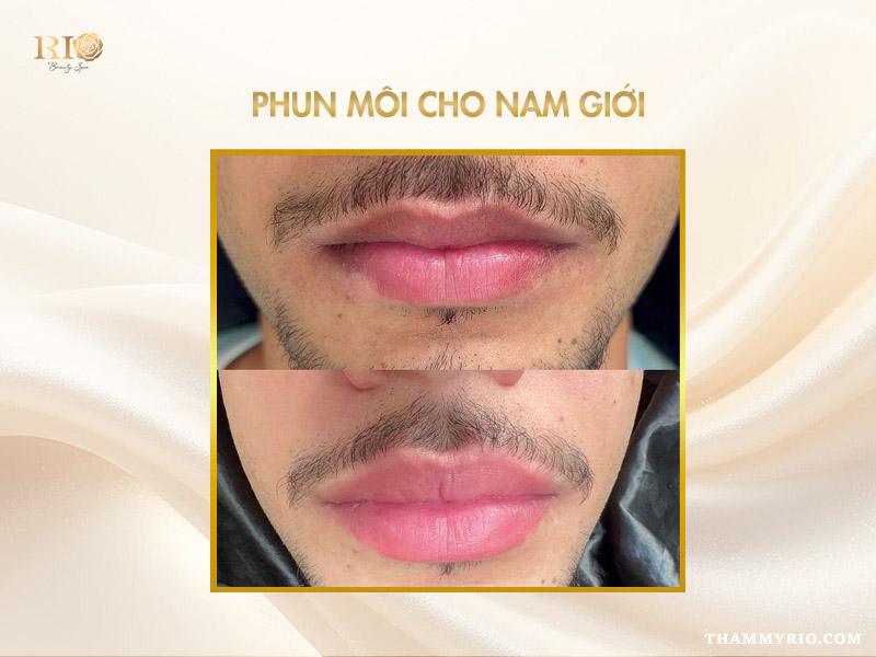 Bảng giá phun môi 2025 - Giá rẻ chất lượng vip, ưu đãi mới 8 Giá phun môi cho nam giới tại Rio