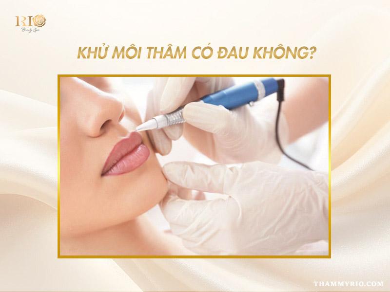 Khử thâm môi có đau không? Khử thâm môi có sưng không? 2 Khử thâm môi có đau không khi thực hiện bằng công nghệ hiện đại tại Rio Beauty Clinic