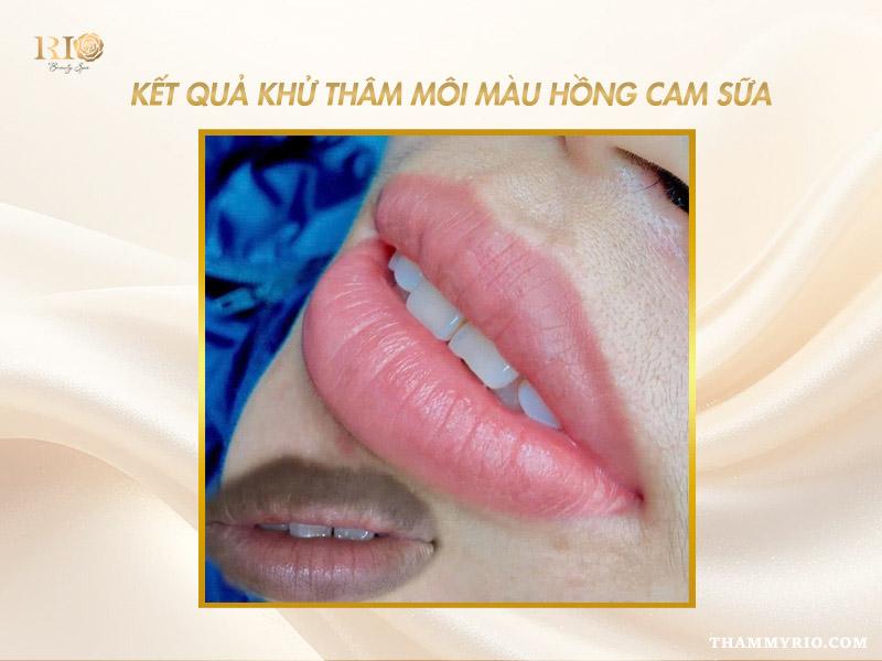 Xu hướng khử thâm môi màu hồng cam sữa đang “gây sốt” 2025 6 Kết quả khử thâm môi màu hồng cam sữa tự nhiên, mềm mịn
