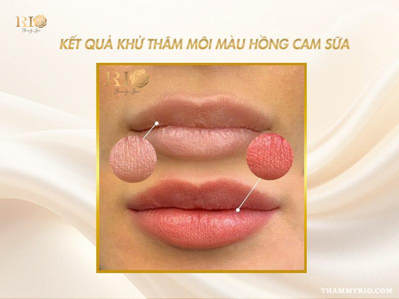 Xu hướng khử thâm môi màu hồng cam sữa đang “gây sốt” 2025 7 Khử thâm môi màu hồng cam sữa cải thiện sắc môi rõ rệt