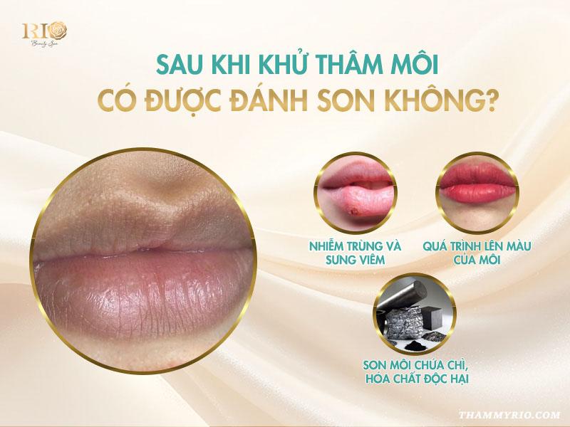 Sau khi khử thâm môi có được đánh son không?
