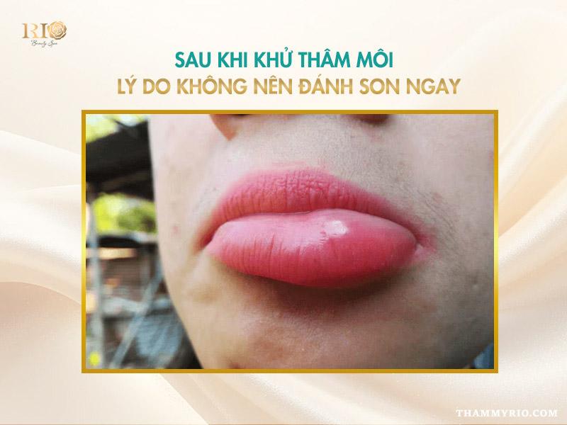 Lý do không nên đánh son ngay sau khi khử thâm môi