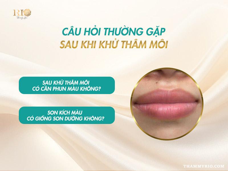 Câu hỏi thường gặp sau khi khử thâm môi