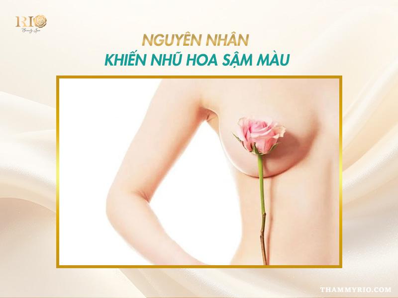 Nguyên nhân khiến nhũ hoa sậm màu và cần khử thâm nhũ hoa