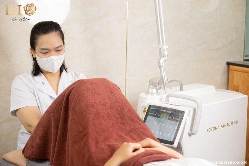 Máy Co2 Fractional Fotona 5D - Chuyên khử thâm và trẻ hóa da 3 Máy Fotona 5D công nghệ tái tạo da đẹp hoàn hảo không tì vết