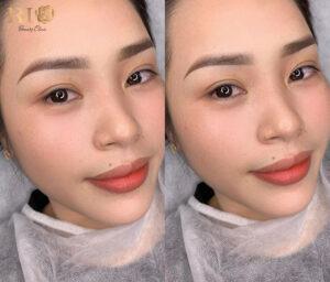 Đôi mày tự nhiên sau phun mày chạm hạt tại Thẩm mỹ Rio.