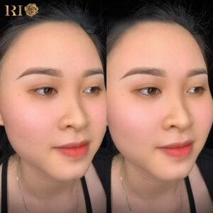 Đôi mày trẻ trung, tươi tắn nhờ phun mày chạm hạt.