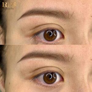 Ảnh cận cảnh đôi mày sau phun mày chạm hạt.