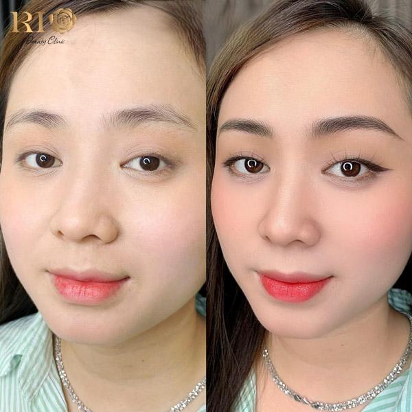 Phun môi có đau không? Giải đáp nỗi lo thường gặp của phái đẹp 5 Kết quả phun môi có đau không tại Thẩm Mỹ Rio với sắc môi hồng tự nhiên