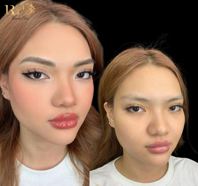 Phun môi có đau không? Giải đáp nỗi lo thường gặp của phái đẹp 6 Hình ảnh sau phun môi có đau không tại Rio Beauty Clinic, môi căng bóng