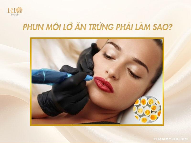 Phun môi có kiêng trứng không? Phun môi kiêng trứng bao lâu? 4 Phun môi lỡ ăn trứng phải làm sao, mẹo xử lý và phun môi kiêng trứng bao lâu cho an toàn