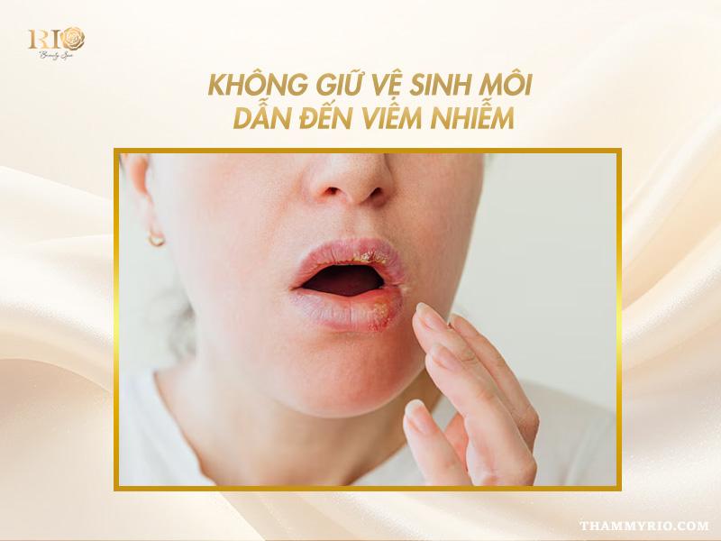 Phun môi màu hồng cam sữa - Sắc môi ngọt ngào trong trẻo 12 Nguy cơ viêm nhiễm do không vệ sinh sau phun môi màu hồng cam sữa
