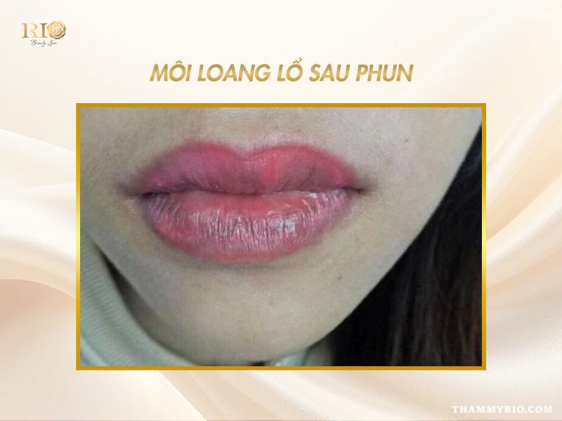 Phun môi màu hồng cam sữa - Sắc môi ngọt ngào trong trẻo 13 Môi loang lổ do chăm sóc sai cách sau phun môi màu hồng cam sữa