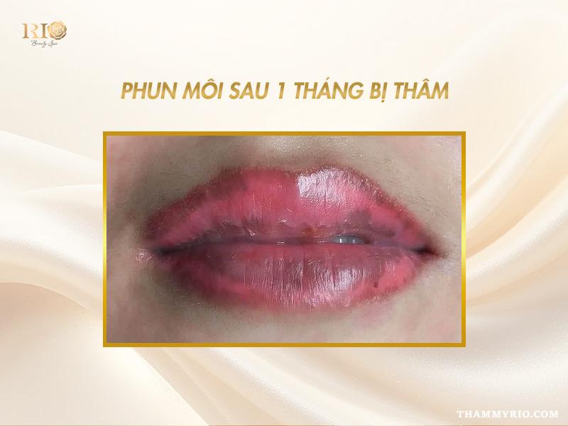 Phun môi sau 1 tháng lên màu chưa? Cách xử lý nếu bị thâm 4 Phun môi sau 1 tháng bị thâm, môi không đều màu