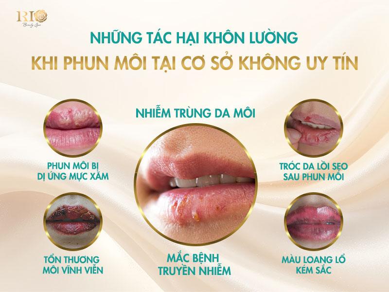 Khôn lường: Tác hại của phun môi tại cơ sở kém chất lượng 3 Tác hại của phun môi tại cơ sở không uy tín