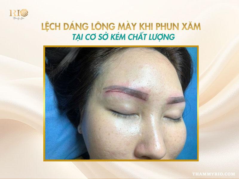 Tác hại của xăm chân mày - Có nên xăm chân mày không? 4 Chân mày bị lệch dáng sau khi xăm gây mất cân đối khuôn mặt