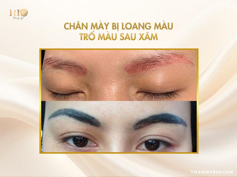 Tác hại của xăm chân mày - Có nên xăm chân mày không? 5 Chân mày loang màu, trổ xanh đỏ do xăm kém chất lượng