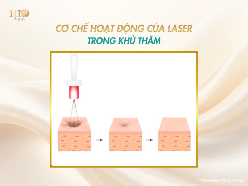 Trị thâm bằng laser có hiệu quả không? Ưu điểm và chi phí? 2 Cơ chế hoạt động của trị thâm bằng laser tác động vào hắc sắc tố dưới da