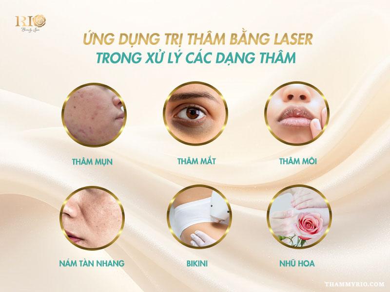 Trị thâm bằng laser có hiệu quả không? Ưu điểm và chi phí? 3 Ứng dụng trị thâm bằng laser trong điều trị thâm mụn, thâm môi, thâm mắt, nám tàn nhang, vùng bikini, nhũ hoa
