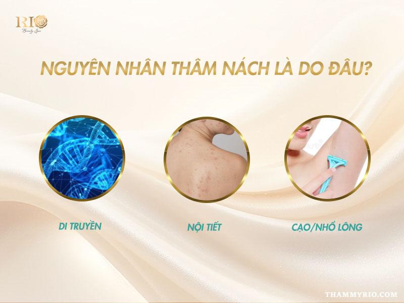 Bật mí những cách trị thâm nách hiệu quả, duy trì lâu dài 2 Để lựa chọn được cách trị thâm nách phù hợp, việc đầu tiên và quan trọng nhất là xác định chính xác nguyên nhân gây ra tình trạng này