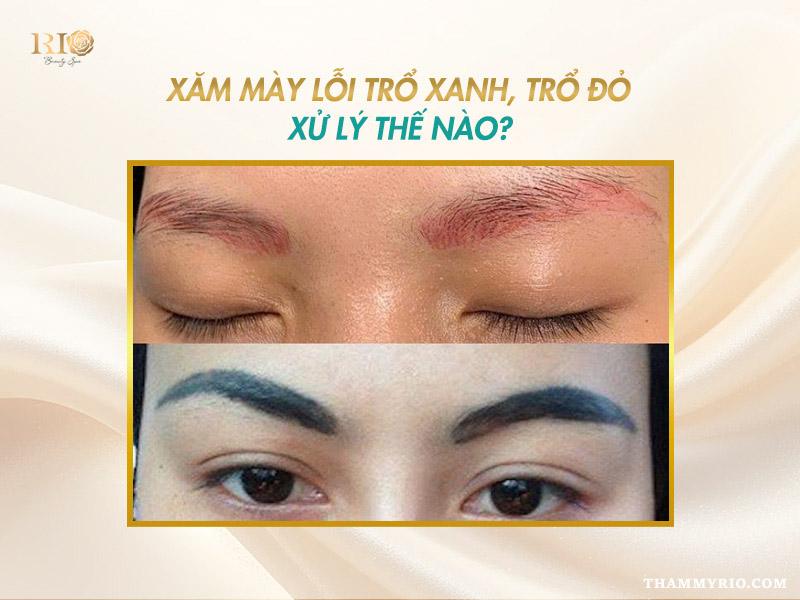 Nguyên nhân xăm chân mày lỗi và hướng khắc phục hiệu quả 3 Hình ảnh xăm chân mày lỗi với tình trạng trổ xanh, đỏ mất tự nhiên.