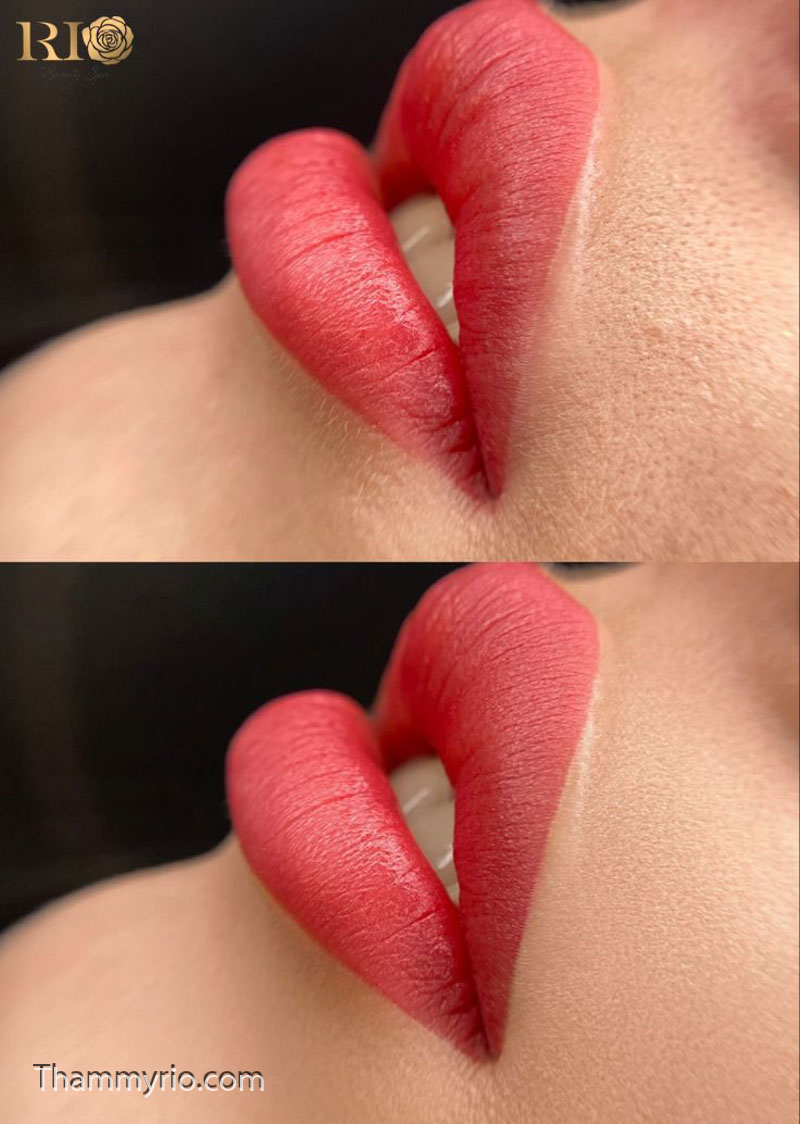 Giá xăm môi đỏ hồng Ruby tự nhiên tại Thẩm Mỹ Rio Beauty Clinic