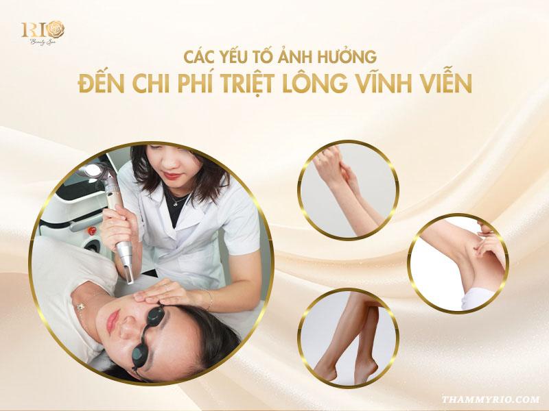 Bảng giá triệt lông vĩnh viễn bao nhiêu? Cập nhật 2025 2 Các yếu tố ảnh hưởng đến chi phí triệt lông vĩnh viễn