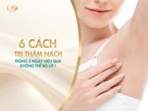 6 cách trị thâm nách trong 3 ngày hiệu quả không thể bỏ lỡ!