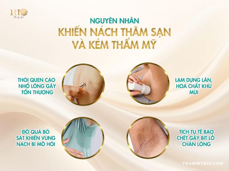 6 cách trị thâm nách trong 3 ngày hiệu quả không thể bỏ lỡ!  3 Hiểu rõ các nguyên nhân giúp bạn lựa chọn giải pháp làm trắng nách phù hợp.