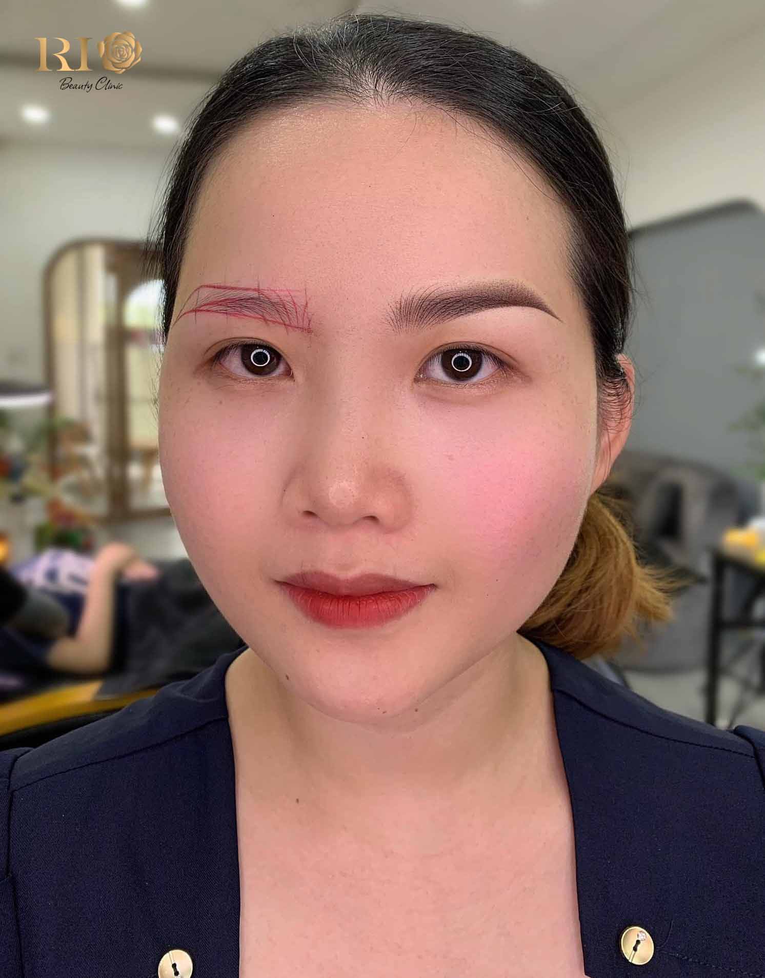 Sự khác biệt trước và sau khi làm dịch vụ