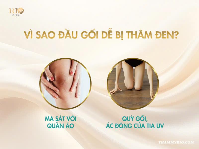 Các cách khử thâm đầu gối tại nhà và spa siêu hot năm 2025 3 Vì sao đầu gối dễ bị thâm đen?