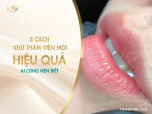 8 cách khử thâm viền môi hiệu quả ai cũng nên biết