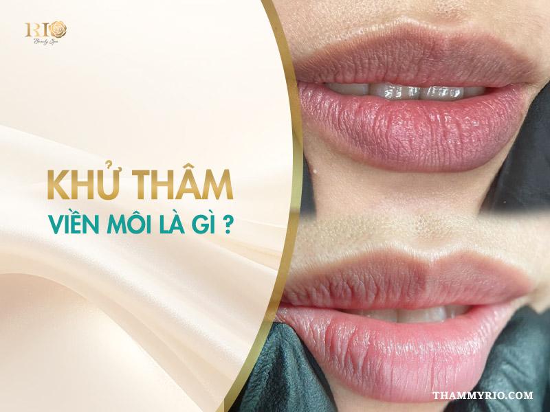 8 cách khử thâm viền môi hiệu quả ai cũng nên biết  3 Khử thâm viền môi là gì?