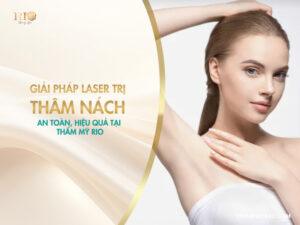 Giải pháp laser trị thâm nách an toàn, hiệu quả tại Thẩm mỹ Rio