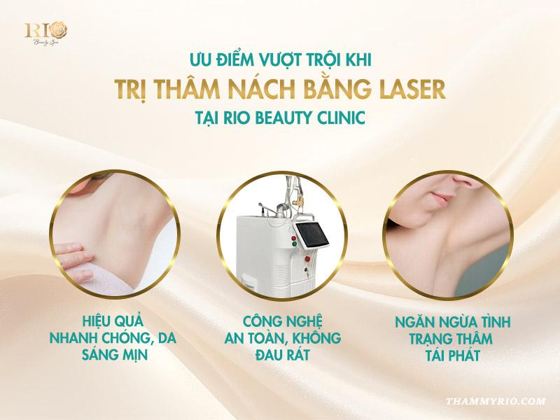 Giải pháp laser trị thâm nách an toàn, hiệu quả tại Thẩm mỹ Rio 6 Ưu điểm vượt trội khi trị thâm nách bằng laser tại Rio Beauty Clinic