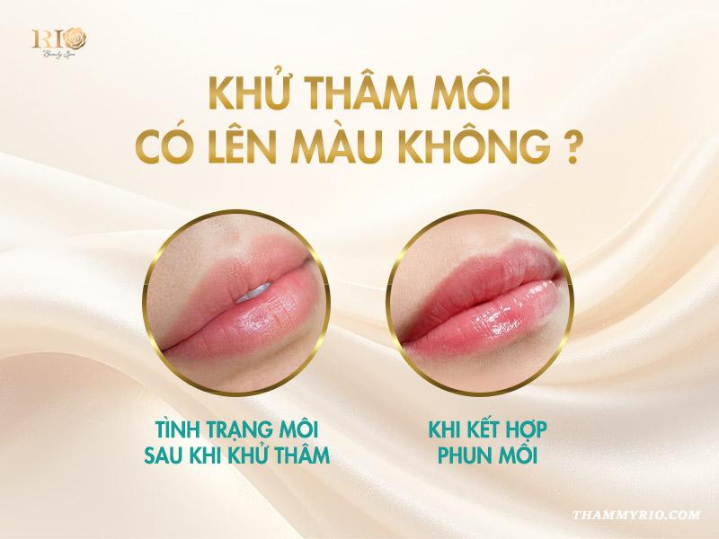 Môi sau khi khử thâm: màu lên thế nào, chăm sóc ra sao? 3 Khử thâm môi có lên màu không?