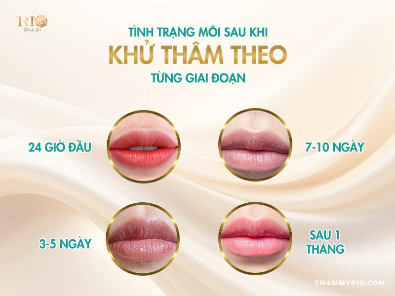 Môi sau khi khử thâm: màu lên thế nào, chăm sóc ra sao? 4 Tình trạng môi sau khi khử thâm theo từng giai đoạn