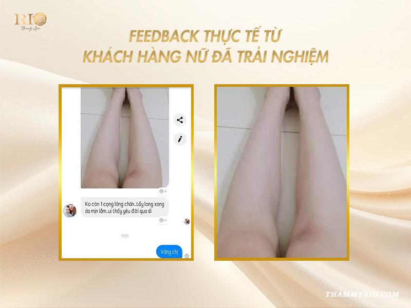 3 cách triệt lông chân vĩnh viễn tại nhà cho nữ siêu hot! 7 Feedback thực tế từ khách hàng nữ đã trải nghiệm dịch vụ tại Thẩm mỹ Rio Beauty Clinic