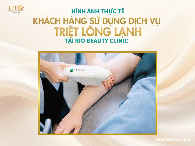 Công nghệ triệt lông lạnh an toàn mới nhất 2025 11 Hình ảnh thực tế khách hàng sử dụng dịch vụ triệt lông lạnh tại Rio Beauty Clinic