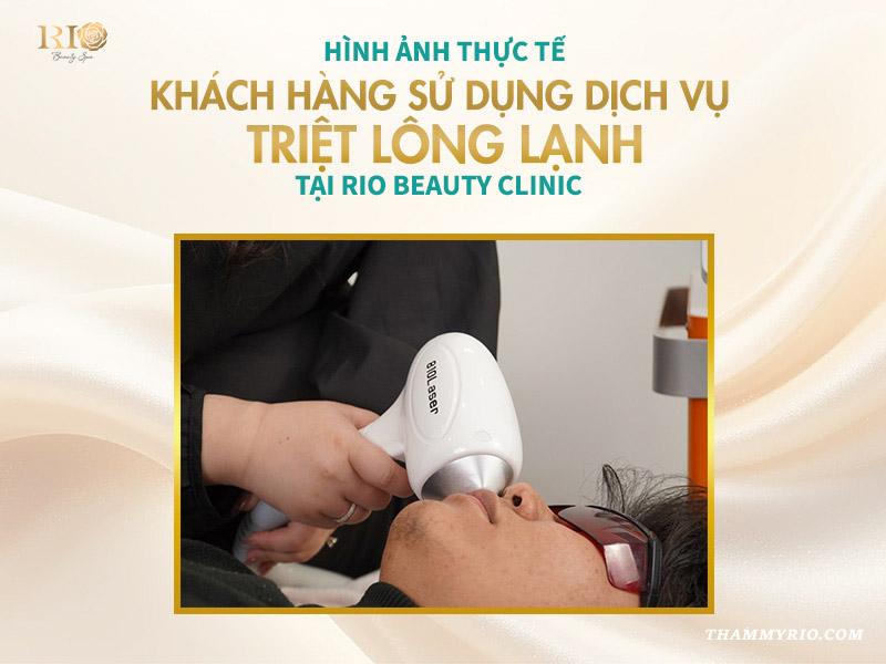 Công nghệ triệt lông lạnh an toàn mới nhất 2025 8 Hình ảnh thực tế khách hàng sử dụng dịch vụ triệt lông lạnh tại Rio Beauty Clinic
