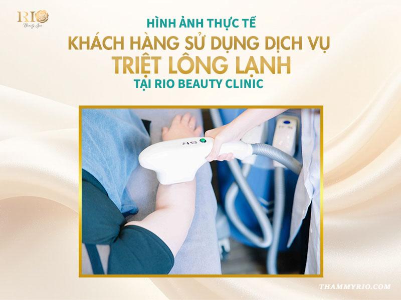 Công nghệ triệt lông lạnh an toàn mới nhất 2025 9 Hình ảnh thực tế khách hàng sử dụng dịch vụ triệt lông lạnh tại Rio Beauty Clinic