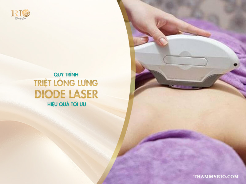 Quy trình thực hiện triệt lông lưng bằng công nghệ Diode Laser cho khách hàng tại spa.