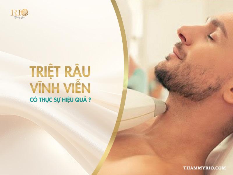 Có nên triệt râu cho nam không? Khám phá lợi ích bất ngờ! 4 Triệt râu vĩnh viễn: Có thực sự hiệu quả?