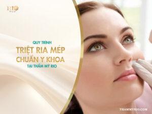 Triệt ria mép: Quy trình chuẩn y khoa tại Thẩm mỹ Rio