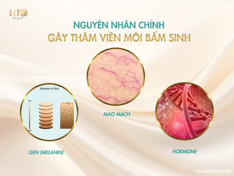 Top 5 cách trị thâm viền môi bẩm sinh dứt điểm an toàn 3 Nguyên nhân gây thâm viền môi bẩm sinh
