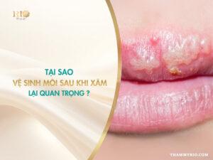 Tại sao vệ sinh môi sau khi xăm lại quan trọng?