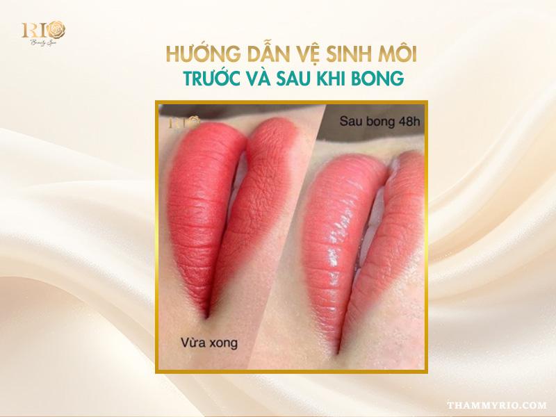 Cách vệ sinh môi sau khi xăm để giữ màu lâu dài 4 Hướng dẫn vệ sinh môi trước khi bong và sau khi bong
