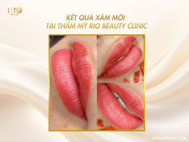 Cách vệ sinh môi sau khi xăm để giữ màu lâu dài 8 Kết quả môi bền đẹp sau khi vệ sinh môi sau khi xăm