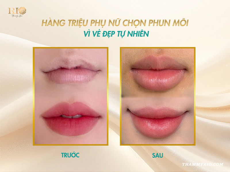 Ảnh trước và sau khi phun môi - bằng chứng có nên phun môi hay không